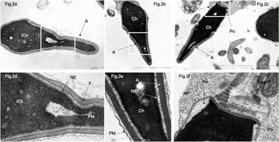 Atypical structure of the nuclear membrane, distribution of nuclear pores and lamin B1 in spermatozoa of patients with complete and partial globozoospermia